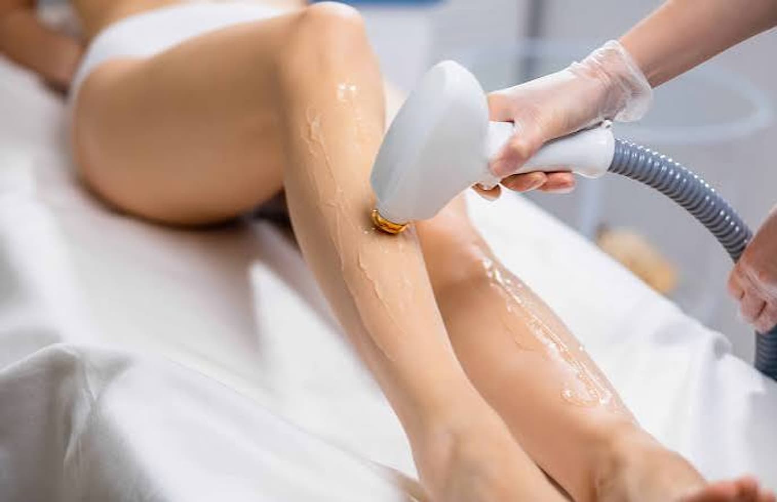 Bacak bölgesine lazer epilasyon uygulaması, jel sürülmüş cilt ve el başlığı